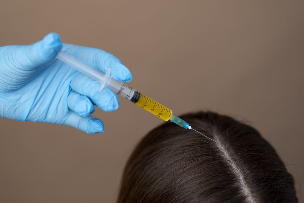 Hand applying PRP Injection for Hair Loss on Female Patient hair at a high angle