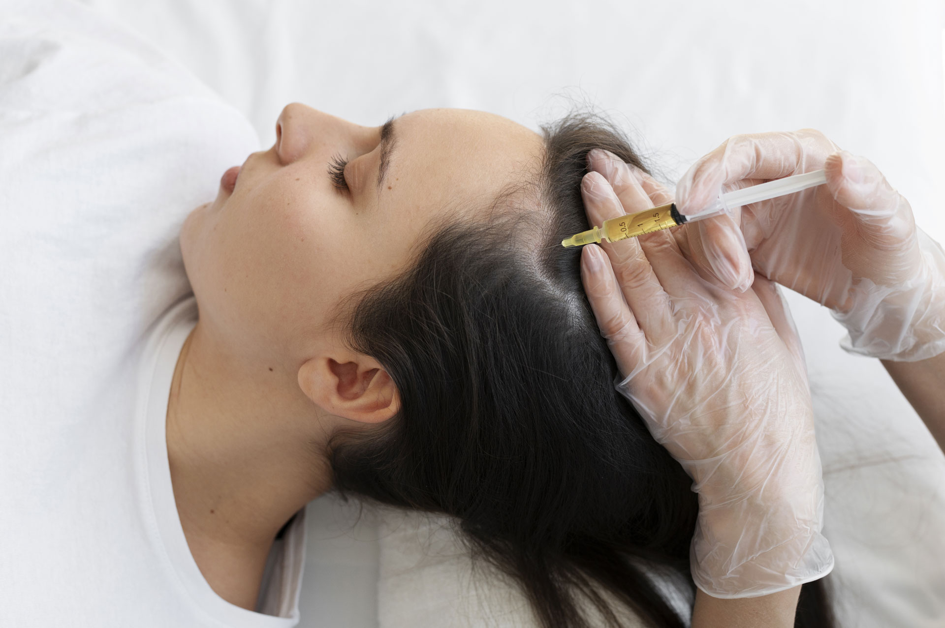 Woman receiving PRP injections for hair loss treatment on her scalp for hair growth